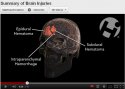 impact brain injuries graphic youtube 2.jpg